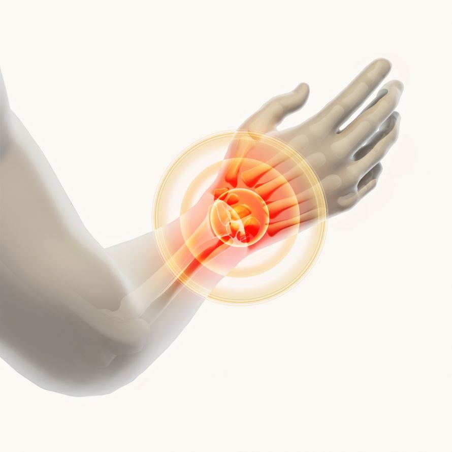 Wrist Pain