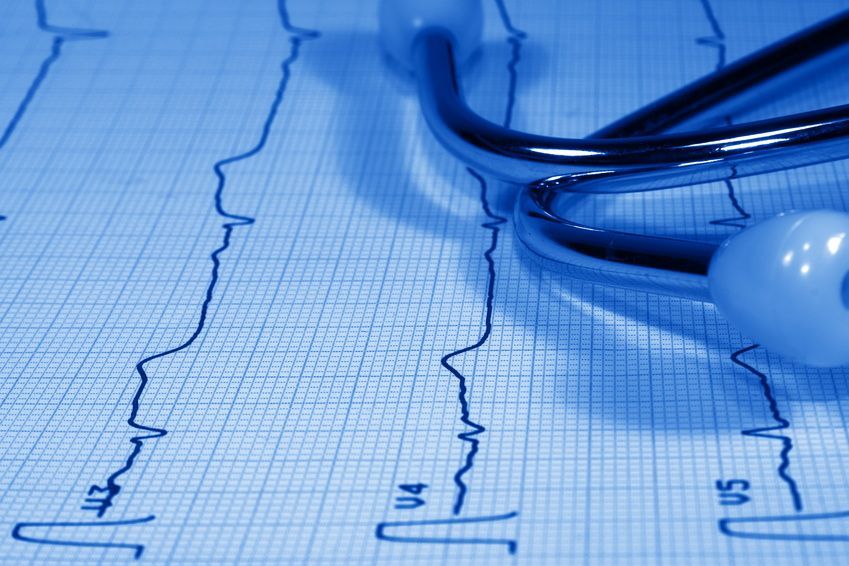 EKG Herzuntersuchung Ηλεκτροκαρδιογράφημα (ΕΚΓ)