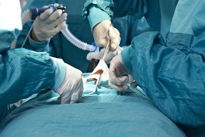 Chirurgie mini-invasive de pontage pour les maladies cardiaques coronariennes