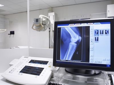 Röntgenuntersuchung Kniegelenk Röntgenuntersuchung Kniegelenk