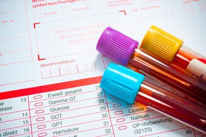 Blutwerte Check-Up-Untersuchung Εξέταση αιματολογικών δεικτών στο πλαίσιο προληπτικού ελέγχου