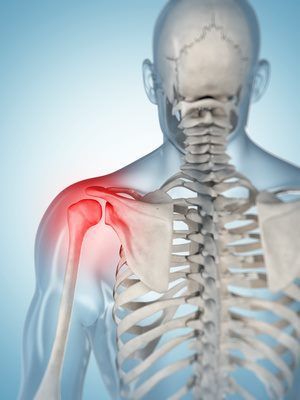 Frozen Shoulder