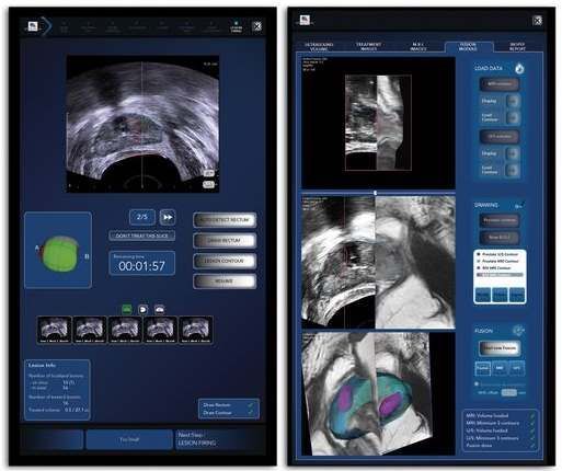 Foto Fusion MRT und Behandlung MRI and Treatment: A Combination