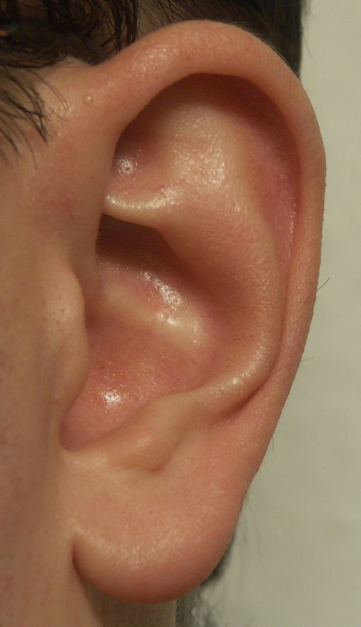 Menschliche Ohrmuschel._Peter Niemayer, CC BY-SA 3.0 Human outer ear._Peter Niemayer, CC BY-SA 3.0