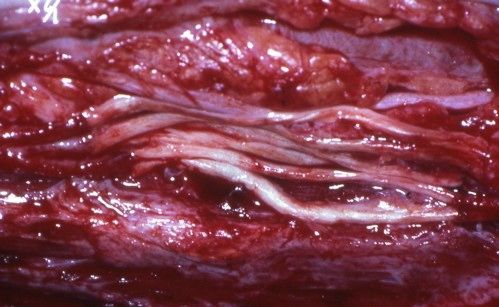 Nervenrekonstruktion3 Ανακατασκευή νεύρων3