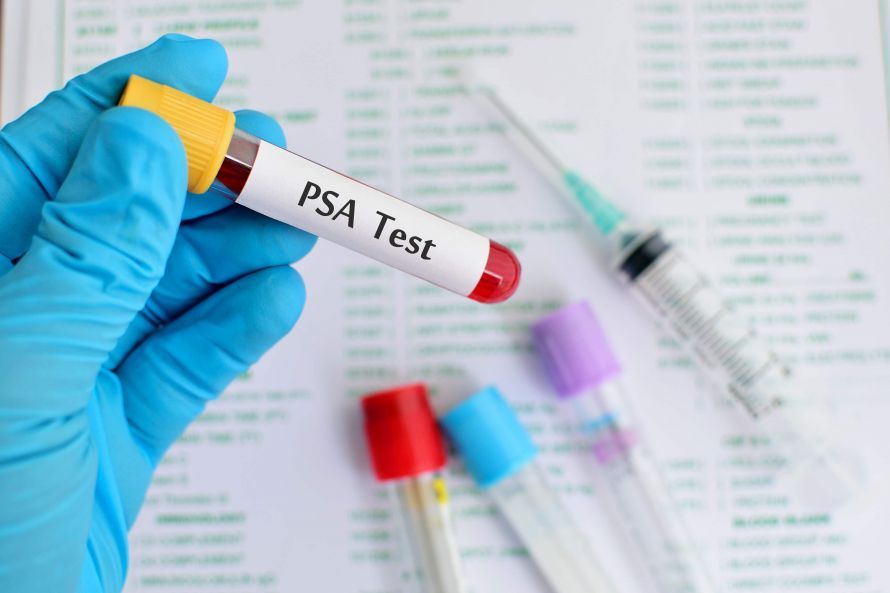 PSA-Test