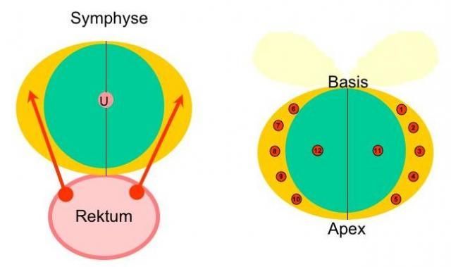 Prostatabiopsie Βιοψία προστάτη