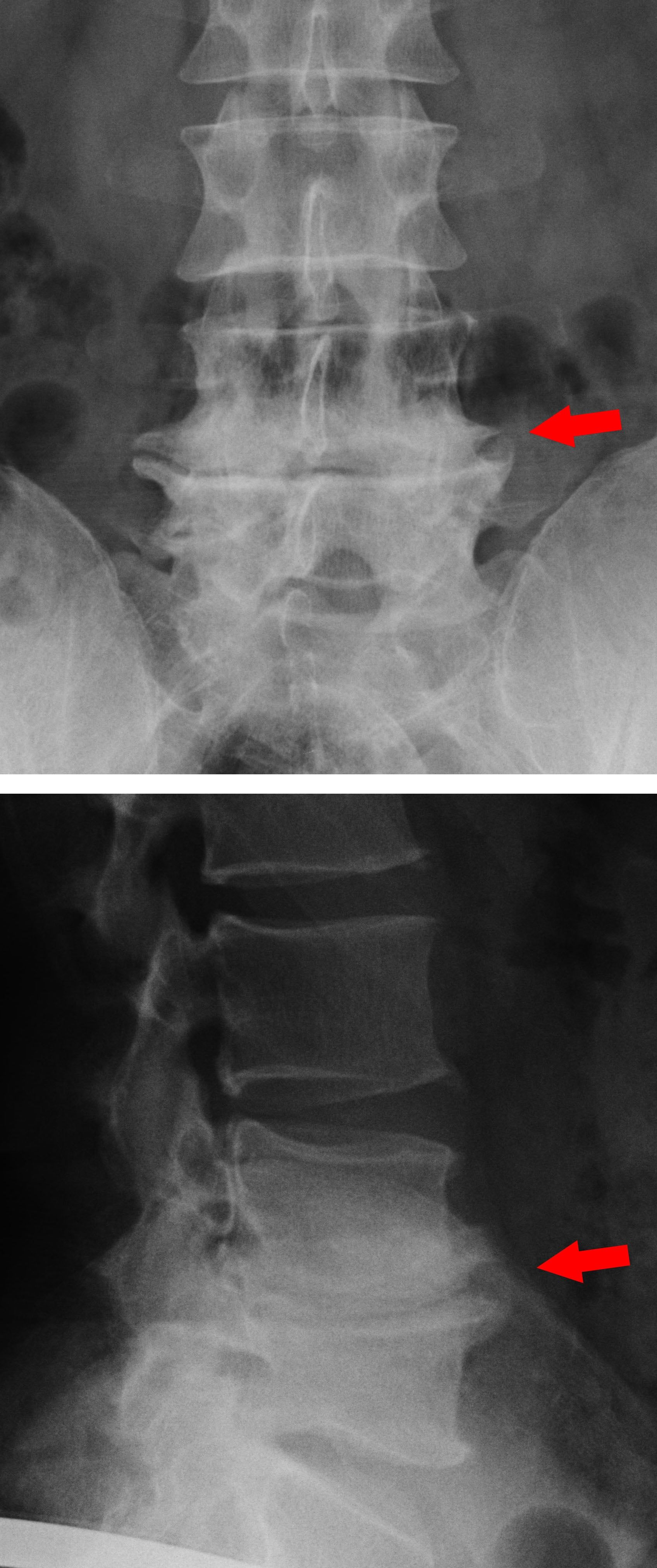 Osteoch-iv.jpg