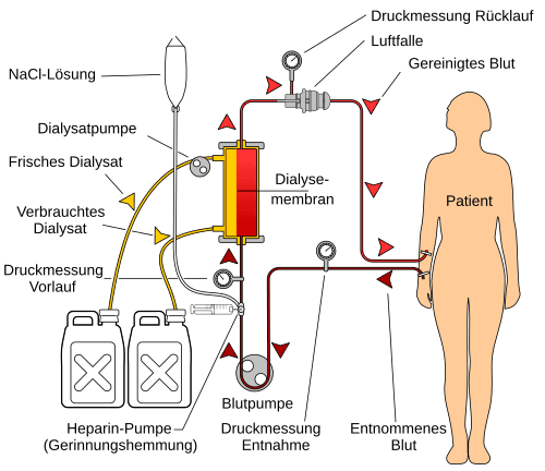Hemodialysis-de.svg