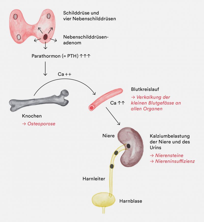 Schematisch gezeichneter Knochen und Nieren Σχηματική απεικόνιση οστών και νεφρών