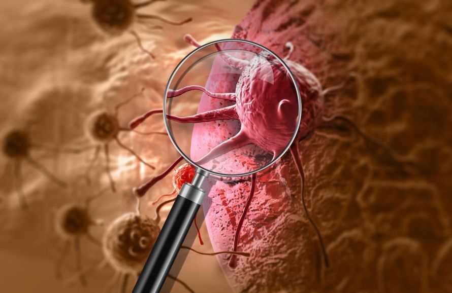 Cancer cell