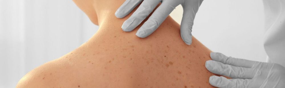 Dermatologie