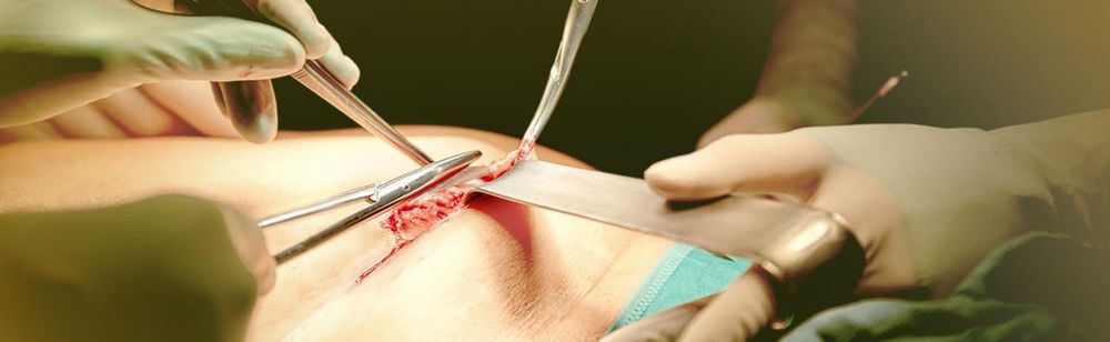 Hernienchirurgie