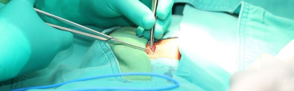 Viszeralchirurgie