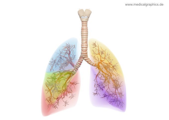 Lungen-OP Aufgrund eines Bronchialkarzinoms entfernen Ärzte bei einer Lungen-OP oftmals einen der fünf Lungenlappen.