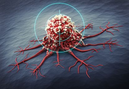 lymph0.jpg