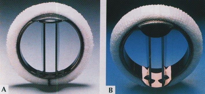 Mechanische Herzklappe Mechanical Heart Valve