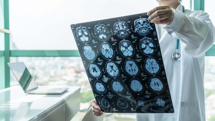 MRT Gehirn Brain MRI