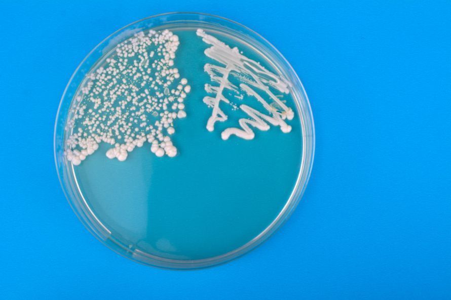 To identify the type of fungus causing the penile yeast infection, a fungal culture is prepared.