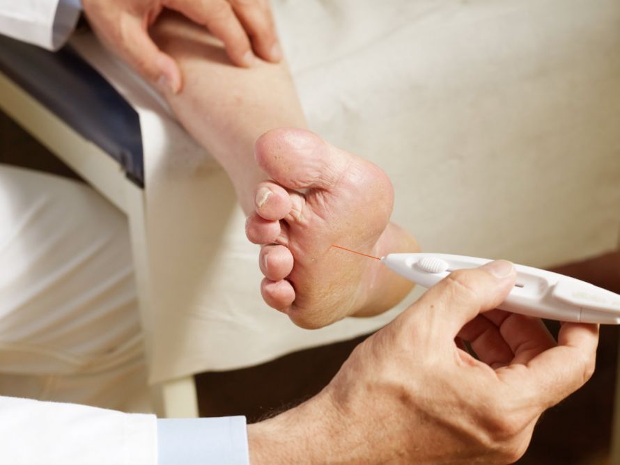 Überprüfung der Muskeln bei der Polyneuropathie-Diagnose Εξέταση των μυών κατά τη διάγνωση της πολυνευροπάθειας