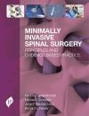 Minimally Invasive Spinal Surgery Schubert Minimally Invasive Spinal Surgery Schubert