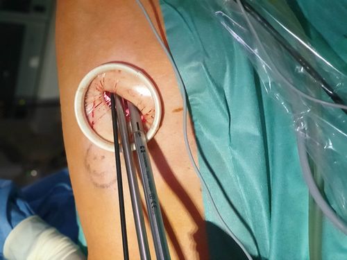 Einblicke: Knappschaft Kliniken Gelsenkirchen-Buer – Bild 4