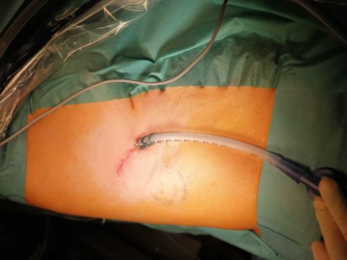 Einblicke: Knappschaft Kliniken Gelsenkirchen-Buer – Bild 5