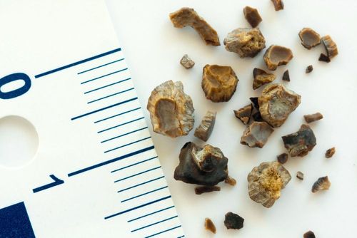 AdobeStock_48684816.jpg