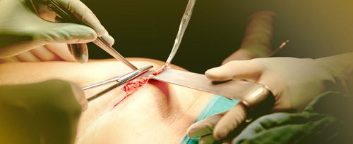 Fachgebiet_Hernienchirurgie.jpg