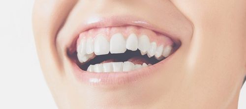 Gummy-smile-Helmut-Lindorf-HL403GC-LMG19-900x400.jpeg