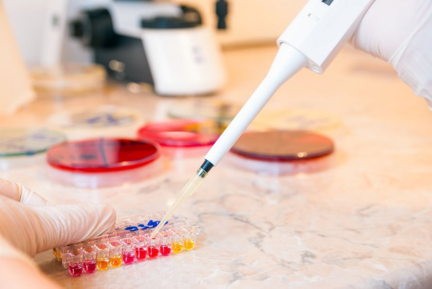 Ureaplasma urealyticum Το βακτήριο Ureaplasma urealyticum μπορεί να ανιχνευθεί στο εργαστήριο.